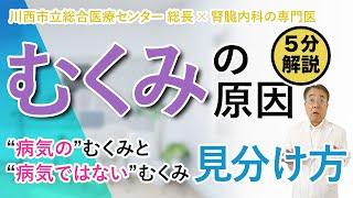 【むくみの原因】”病気”のむくみと”病気ではない”むくみの見分け方を教えます