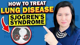 How to Treat Lung Disease in Sjogren's Syndrome ?