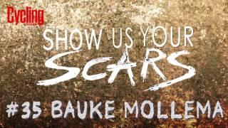 Show us your scars: Bauke Mollema #35