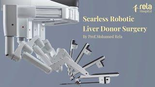 Watch Prof. Mohamed Rela performing a Scarless Robotic Liver Donor Surgery