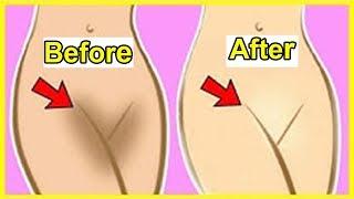 in Just 5 Minutes, Lighten Your Dark Private area Naturally At Home & Specially for Girls,100% works