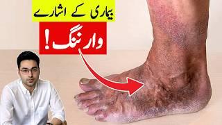 Dr. Zee:Use Your Feet As Warning Signs | डॉक्टर ज़ी