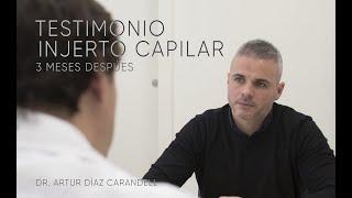 Testimonio Injerto Capilar técnica FUE