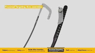 T2 Alpha Femur Retrograde Nailing System | Surgical Animation