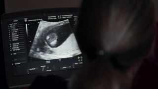 Advanced Early Pregnancy Scan