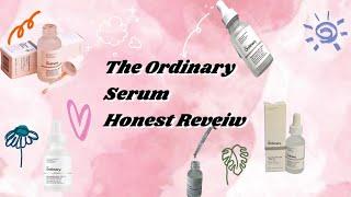 My Honest Review of "The Ordinary Niacinamide Serum" || The Skincare Game changer?