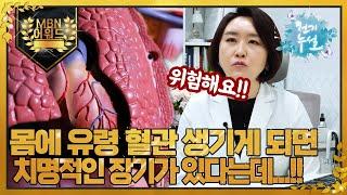 [최고의 5분_천기누설] 혈관이 사라진다? 유령 혈관의 경고와 치명적인 장기 MBN 220401 방송