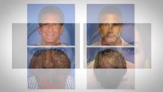 Bitner Facial Plastic Surgery