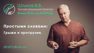 Грыжа позвоночника что это такое? | Мануальный терапевт в Марьино, Москва