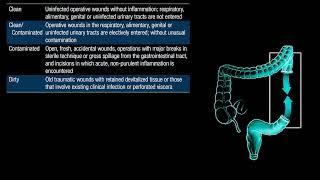 Radiology Non-Interpretative Skills: Operative Wound Classification #Radiology #Surgery #residency