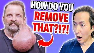 Plastic Surgeon Reacts to MASSIVE Face Growth Removal! EXTREME BODIES EXPLAINED!