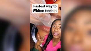 Fastest way to whiten your teeth. #whiteteeth #hygienist