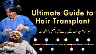 Ultimate Guide to Hair Transplant I Dr Salman aka Dr. MSK I #fue #hairtransplant #plasticsurgeon