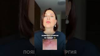 Аллергия на солнце. Как помочь? (В комментарии)