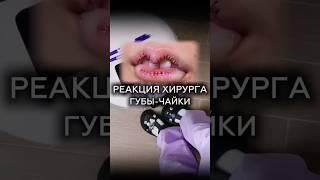 Губы-чайки #увеличениегуб #тренд #тренды #корея #кореянки
