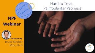 Hard to Treat: Palmoplantar Psoriasis