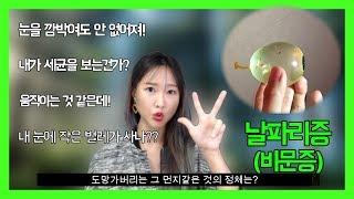 눈 앞에 떠다니는 먼지같은 것들의 정체는?! (비문증) -리카유레카