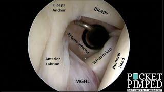 The Basics of Shoulder Arthroscopy