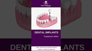 Dental Implants treatment with Best Dental Experts in Hyderabad.