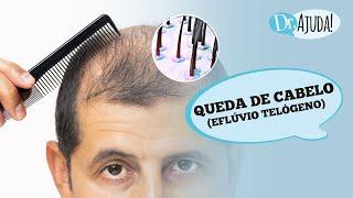 QUEDA DE CABELO (EFLÚVIO TELÓGENO): O QUE É, CAUSAS, DIAGNÓSTICO E TRATAMENTO