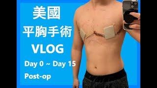 我在美國做平胸手術了!  | I did my top surgery in US! Day 0 ~ Day 15 Post-op Vlog