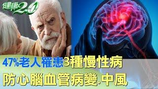 47%老人罹患3種慢性病！ 防心腦血管病變.中風 健康2.0