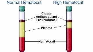 Surprises in Coagulation Testing–Prolonged APTT & PT Case [Hot Topic]