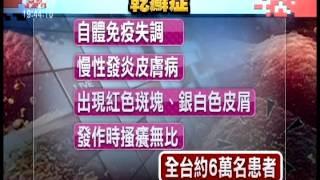 20120906 公視晚間新聞 自體免疫系統失調 乾癬病難根治