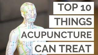 The Top 10 Conditions Acupuncture Can Help