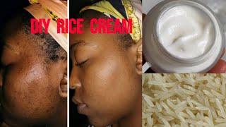 DIY whitening rice Cream with homemade rice starch| Get 10 Years Younger | Antiageing