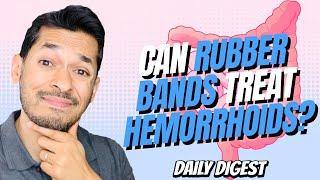 Does Rubber Bands On Hemorrhoids Last?