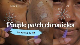 Pimple Patch Chronicles | I’m moving to Barbados  | compilation II #omg #pimplepatch