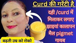 सिर्फ 3 uses में झाइयां, कालापन, wrinkal #pigment गायब 50 की उम्र में 35 के दिखे#skintightening