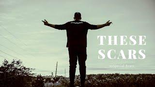 Hard Trap Sample No Drums | Meek Mill Loop | "These scars" (prod. soSpecial)