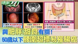 與肥胖、甜食有關！50歲以下腰圍超標易罹腸癌  健康2.0