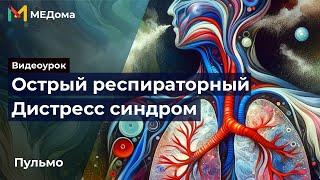 Острый респираторный дистресс синдром - ОРДС: патогенез, причины, лечение | Медома | USMLE step 1