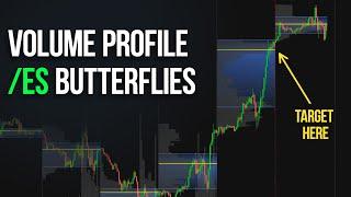 Using the Volume Profile to Trade /ES Options | Futures Butterfly Spread