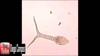 Schistosoma mansoni -  Cercaria