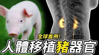 全球首例人體移植豬腎手術成功！如何解決器官排斥問題？