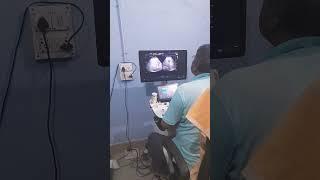 ultrascan liver  docter raj #manish 12th mvp