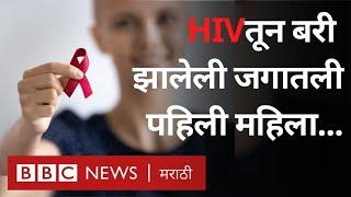 HIV AIDS Cure found? HIV एड्स मुक्त होणारी पहिली महिला कोणते उपचार घेत होती? ART, PrEP treatment