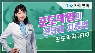 포도막염의 진단과 치료법은? | 포도막염 진단, 치료법 | 망막질환 | 안과질환 | 카이안과TV