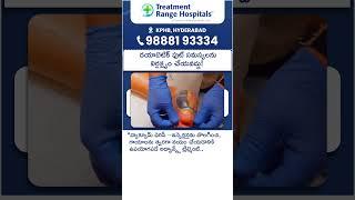 Diabetic Foot Care in Telugu || Treatment Range Hospital || #shorts #ytshorts #diabeticfootcare