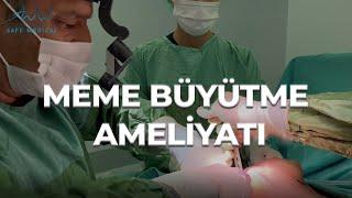 Meme Büyütme Ameliyatı | Göğüs Büyütme Operasyonu | Prof. Dr. Bekir Atik