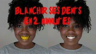 Blanchir ses dents naturellement en 2 minutes chrono