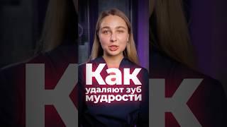  НЕ ДЕРГАЙТЕСЬ! Удаление зуба мудрости — это просто? #СтоматологияБезМифов #УдалениеЗубаМудрости