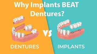 Dentures Versus Dental Implants: Which is Right for You? | DentaVacation