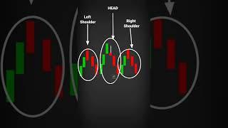 The HEAD & SHOULDER Trend Reversal Pattern #shorts