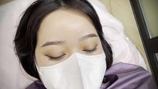 강남 수노아 반영구 눈썹 콤보 시술 영상 - Korea Soonoa permanent Eyebrow Combo Treatment