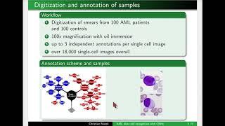 Recognition of AML Blast Cells in a Curated Single-Cell Dataset of Leukocyte Morphologies Using CNN